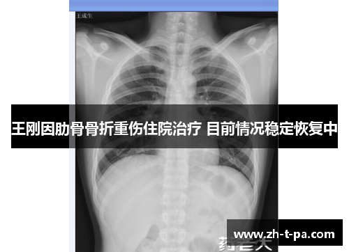 王刚因肋骨骨折重伤住院治疗 目前情况稳定恢复中 王刚因肋骨骨折重伤住院治疗 目前情况稳定恢复中
